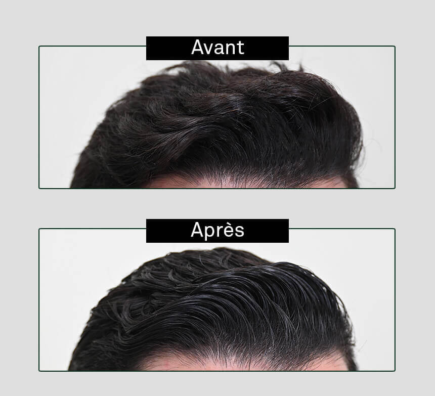 haarsträubendes Wachs gegen Haarausfall